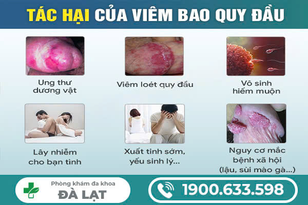 Hình ảnh minh họa